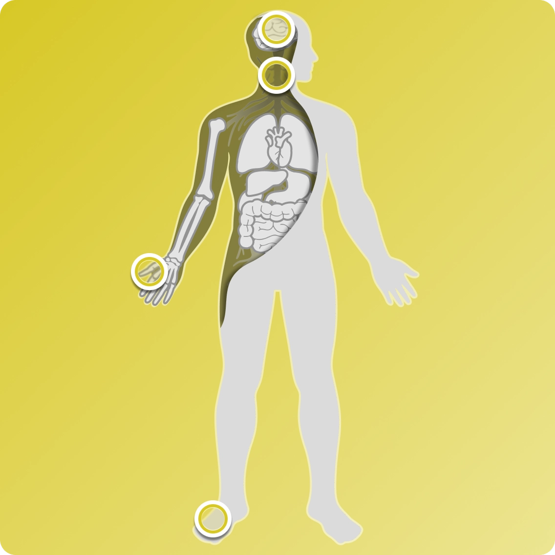 Graphic of human body outline showing possible symptom locations