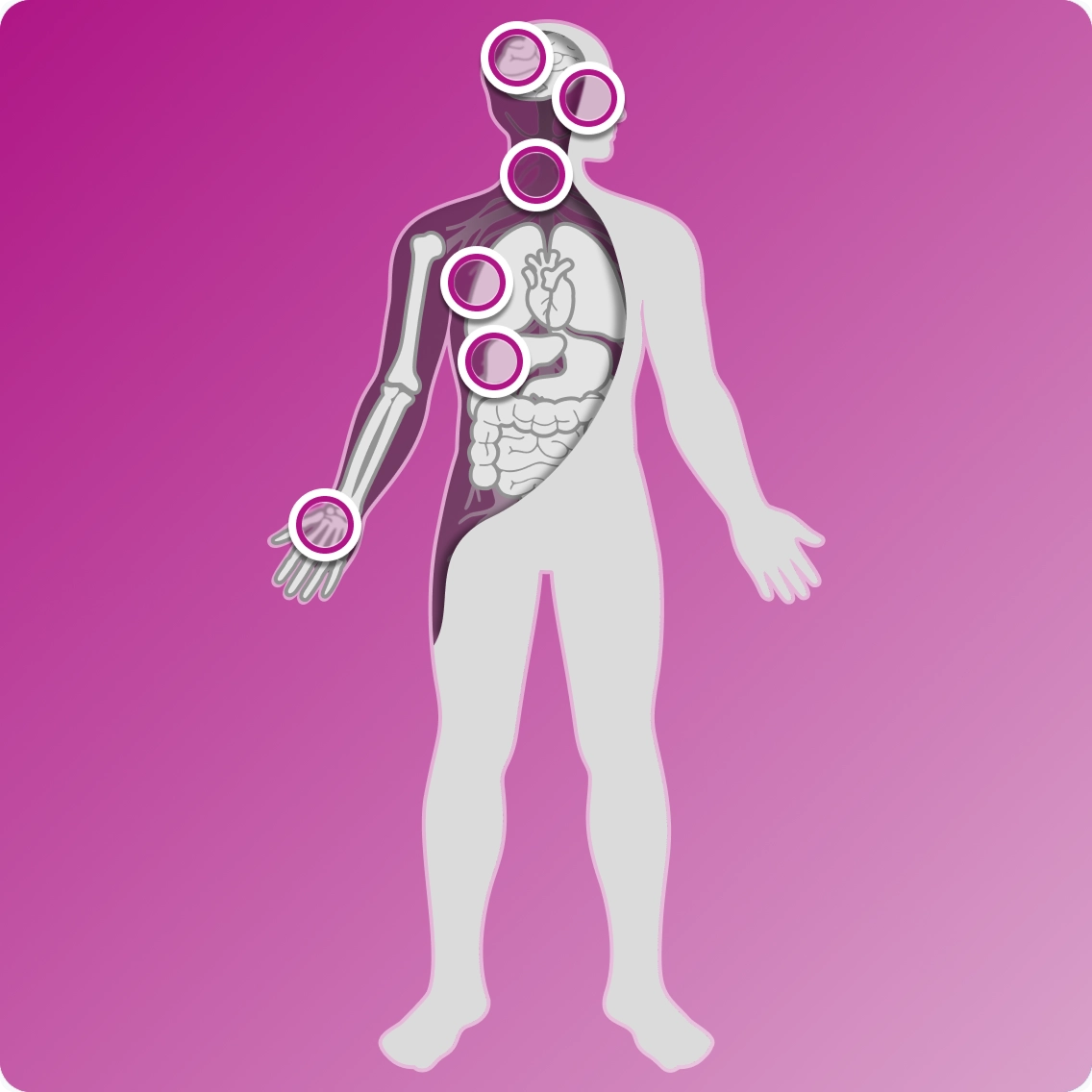 Graphic of human body outline showing possible symptom locations
