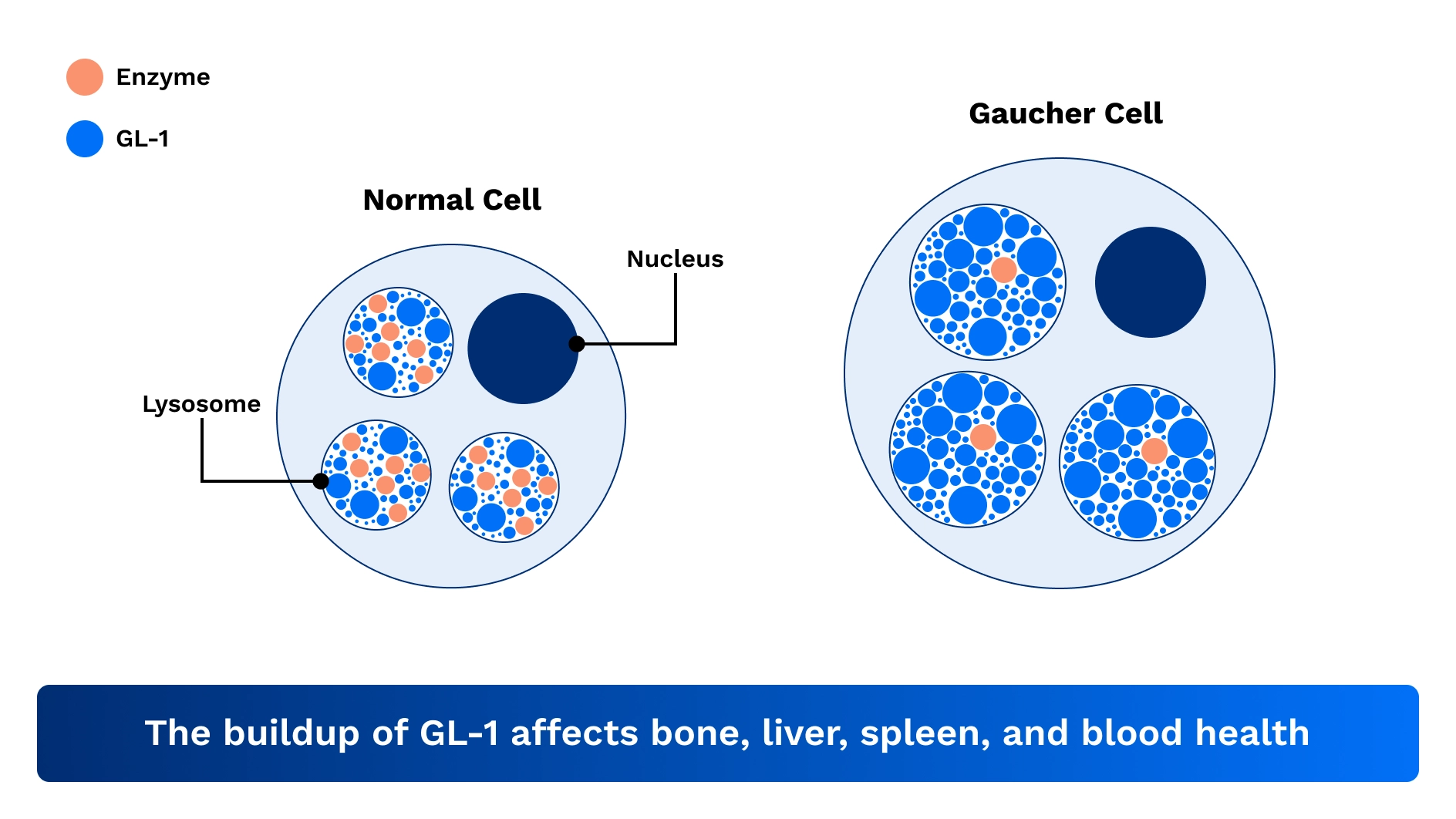 Normal and altered GBA1 gene