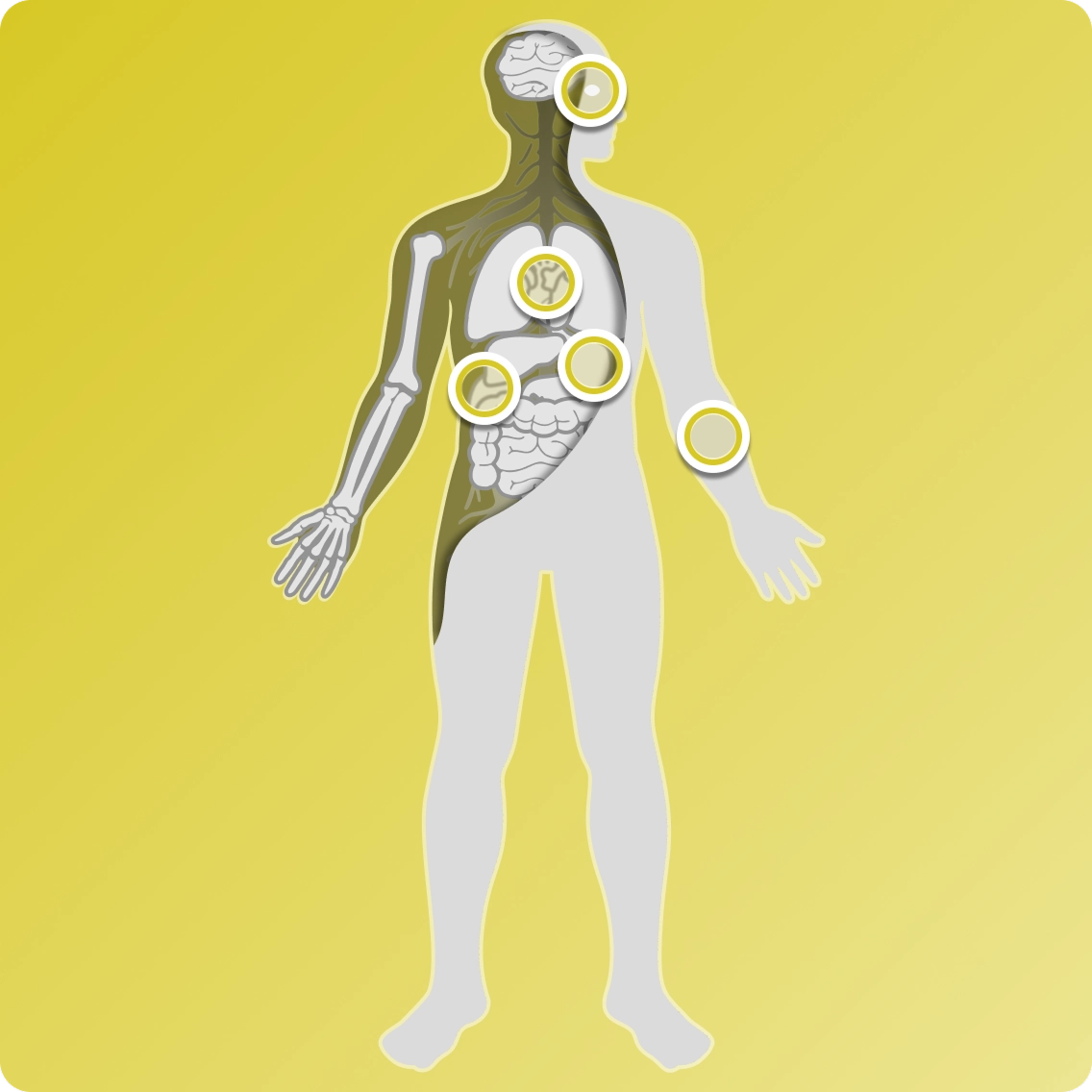 Graphic of human body outline showing possible symptom locations