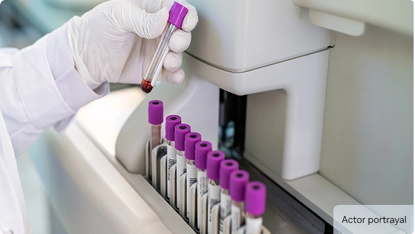 Photo of test tubes in a laboratory